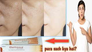 Bellissa lite cream review  benefits side effects  in hindi  Jaaniye pura sach [upl. by Keven58]