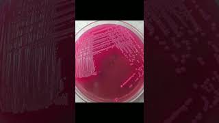 Growth of E Coli bacteria on various type of culture medi [upl. by Abdella]