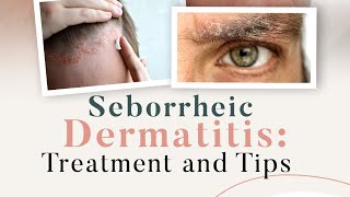 Seborrheic Dermatitis Treatment and Tips [upl. by Nad]