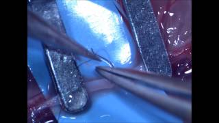 Microsurgical arterial endtoend anastomosis basic technique [upl. by Halden574]