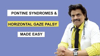 PONTINE SYNDROMES amp HORIZONTAL GAZE PALSY MADE EASY [upl. by Alegnasor373]