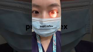 pupil reflex [upl. by Anilram]