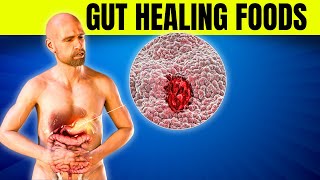 6 Best Prebiotic Foods for Ultimate Gut Health Balance [upl. by Nollid758]