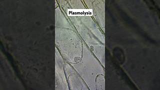 Plasmolysis and Osmosis biology gcse [upl. by Marlie780]