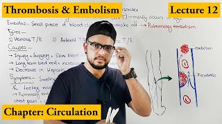 Thrombosis amp Embolism Cardiovascular Disorder  Chapter circulation  Video  12 [upl. by Dare109]