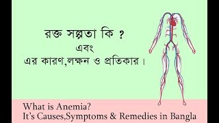 রক্তসল্পতা কি এর কারণ লক্ষন ও প্রতিকার  What is Anemia It’s CausesSymptoms amp Remedies in Bangla [upl. by Anaahs]