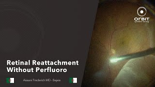 Retinal reattachment without perfluoro [upl. by Darci267]