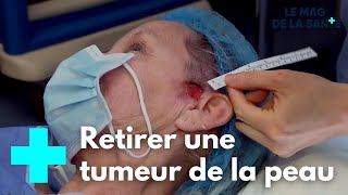 Les prouesses de la chirurgie réparatrice 55  Le Magazine de la Santé [upl. by Anada]