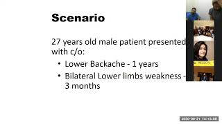 Spinal Neurofibroma 21st September 2020 [upl. by Deena]