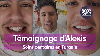 SOINS DENTAIRES EN TURQUIE  🦷 Témoignage d’Alexis  20 couronnes Emax et gummy smile  BODYEXPERT [upl. by Nallek]