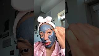 Skincare tips for hormonal acne🙌🏼 acne skincaretips are [upl. by Sirraf]