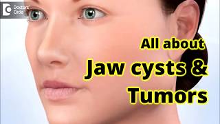 Jaw Cysts amp Tumors Diagnosis amp Treatment  Dr Girish Rao [upl. by Delmor]