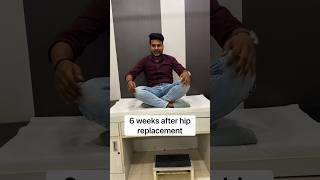 Recovery time in MIS Hip replacement totalhipreplacementsurgery shortsindia [upl. by Etiragram]