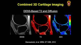 ISMRM MR Academy  Acceleration Methods for Musculoskeletal Imaging [upl. by Imak675]