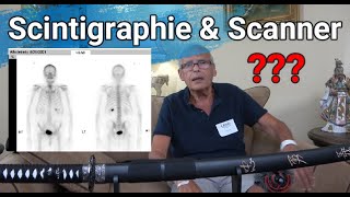 Cancer Scintigraphie osseuse et Scanner thoracique et abdominal après injection lattente [upl. by Ingaborg]