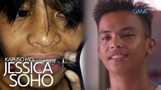 Kapuso Mo Jessica Soho Peligrosong DIY braces [upl. by Rainer]