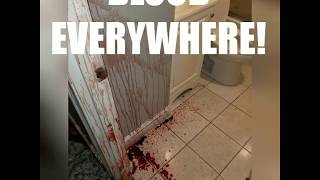 BLOOD EVERYWHERE Man dies a brutal death  Boston trauma amp crime scene cleanup company responds [upl. by Otcefrep]