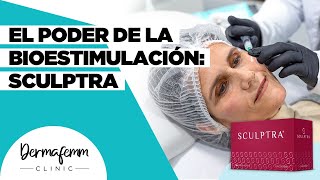 ¿CONOCES EL PODER DEL SCULPTRA  Bioestimulación Natural [upl. by Eirahcaz581]