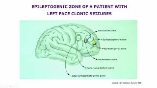 AES 2023 Epilepsy Specialist Symposium  The Frontal Lobe Bermudas Triangle [upl. by Noirda]