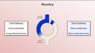 Intro to EKG Interpretation  Mechanisms of Tachyarrhythmias [upl. by Imerej786]