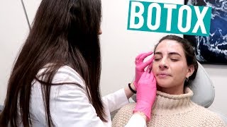 BOTOX FOREHEAD  First Time [upl. by Liahkim]