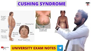 Cushing Syndrome  Endocrine Physiology [upl. by Novanod293]