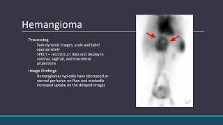 GI Imaging Liver Pathology [upl. by Nanice]