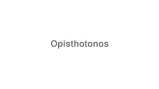 How to Pronounce quotOpisthotonosquot [upl. by Esoj]