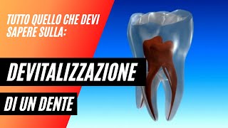 Devitalizzazione di un dente Tutto quello che devi sapere [upl. by Aliuqaj]