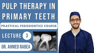 Lecture 03  Pulp Therapy in Primary Teeth  Pulpotomy vs Pulpectomy  كورس بيدو عملي [upl. by Lajet]