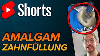 Amalgamfüllung shorts [upl. by Artemisia]