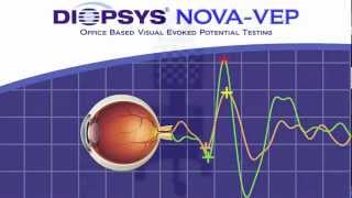 Diopsys NOVAVEP Vision Test  Eye Care [upl. by Thayer]