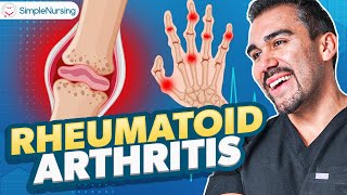 Rheumatoid Arthritis Diagnostics  Nursing Immunosuppressants Osteoarthritis [upl. by Fedora464]