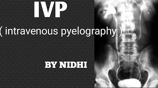 IVP  Intravenous pyelography  procedure in hindi  IVP Procedure [upl. by Anirrok]