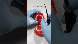 Luxating Maxillary Teeth 🦷  OnlineExodontiacom  dentist dentistry dentalschool [upl. by Luy119]