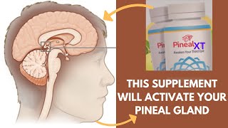 ACTIVATE YOUR PINEAL GLAND and UNLOCKS UNLIMITED ABUNDANCE AND PROSPERITY  pinealxt [upl. by Yenrab]