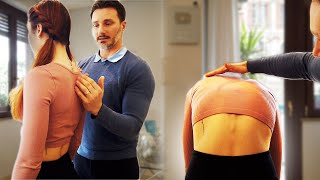 I Couldnt Believe the Transformation Before amp After a Scoliosis Treatment [upl. by Yehc]