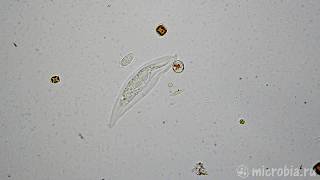 Litonotus eats 2 ciliates  Литонотус съедает 2х инфузорий [upl. by Asiret78]