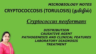 Cryptococcosis Torulosis  Cryptococcus neoformans  pathogenesis lab diagnosis treatment Tamil [upl. by Olvan]