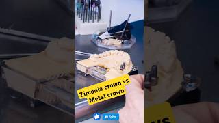 Zirconia crown vs Metal crown oralhealth dentist dentalclinic doctor viralvideo shirtscrown [upl. by Waine383]