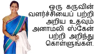 ஒரு கருவின் வளர்ச்சியைப் பற்றி அறிய உதவும் அனாமலி ஸ்கேன் பற்றி அறிந்து கொள்ளுங்கள் [upl. by Lu]