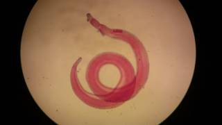 Adult male of Schistosoma haematobium [upl. by Adamec]