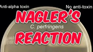 Naglers reaction clostridium perfringens in hindi [upl. by Halas]