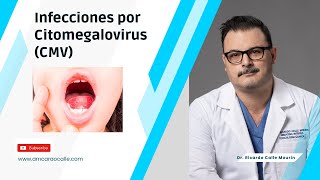 Infecciones por Citomegalovirus CMV  Paciente inmunocompetente y paciente inmudodeprimido [upl. by Ettennek]