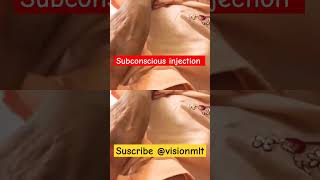 injection Subcutaneoushow to adminitration injectio YouTubeshorts ytshorts shorts [upl. by Drugi]