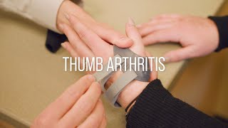 Thumb Arthritis Symptoms Causes and Treatment [upl. by Rednave903]