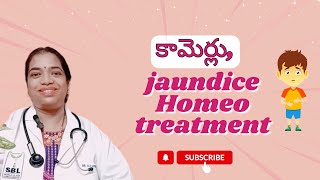 కామెర్లు jaundiceHomeo treatment SudharamanHomeoClinic [upl. by Kieger]