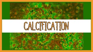 Dystrophic vs Metastatic Calcification [upl. by Iahcedrom722]