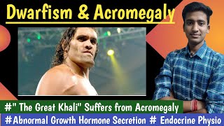 Acromegaly amp Dwarfism amp Gigantism  Growth HormoneEndocrine Physiology  in hindi Ashish [upl. by Tatia974]