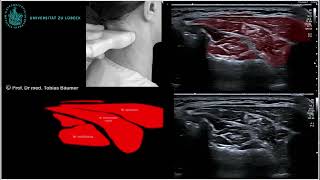 Sonographische Darstellung der Nackenmuskeln und der Übergang zu den langen Nackenmuskeln [upl. by Buzzell]